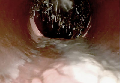 screenshot of sewer video inspection showing broken pipe and roots